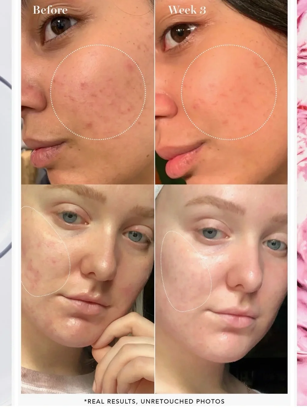 Saturday Skin 10% Glycolic Pore Control Toner
